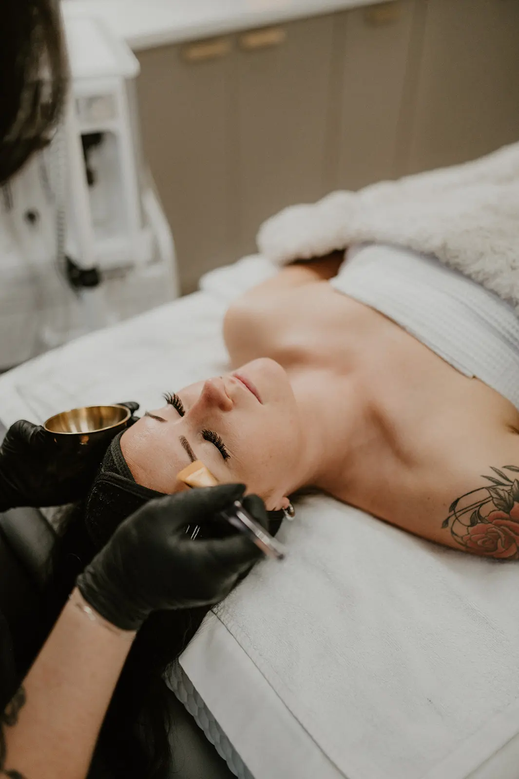 VI Chemical Peel | FG Aesthetics & Medicine | Missoula, MT