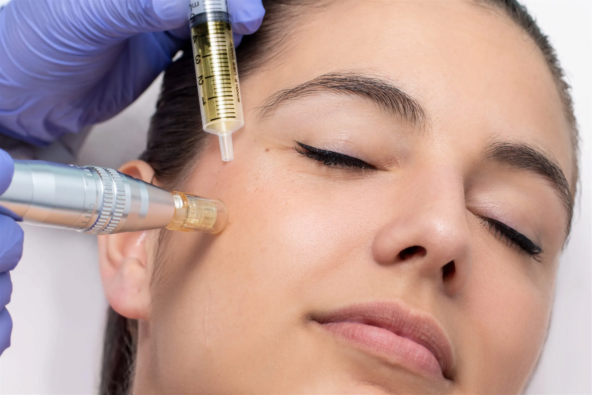 Microneedling Treatment | FG Aesthetics & Medicine | Missoula, MT