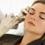 Dermal Fillers Treatment by FG Aesthetics & Medicine in Missoula, MT