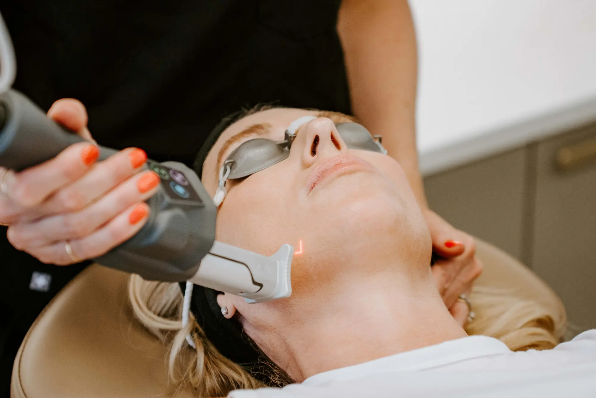 CO2 Laser Treatment | FG Aesthetics & Medicine | Missoula, MT