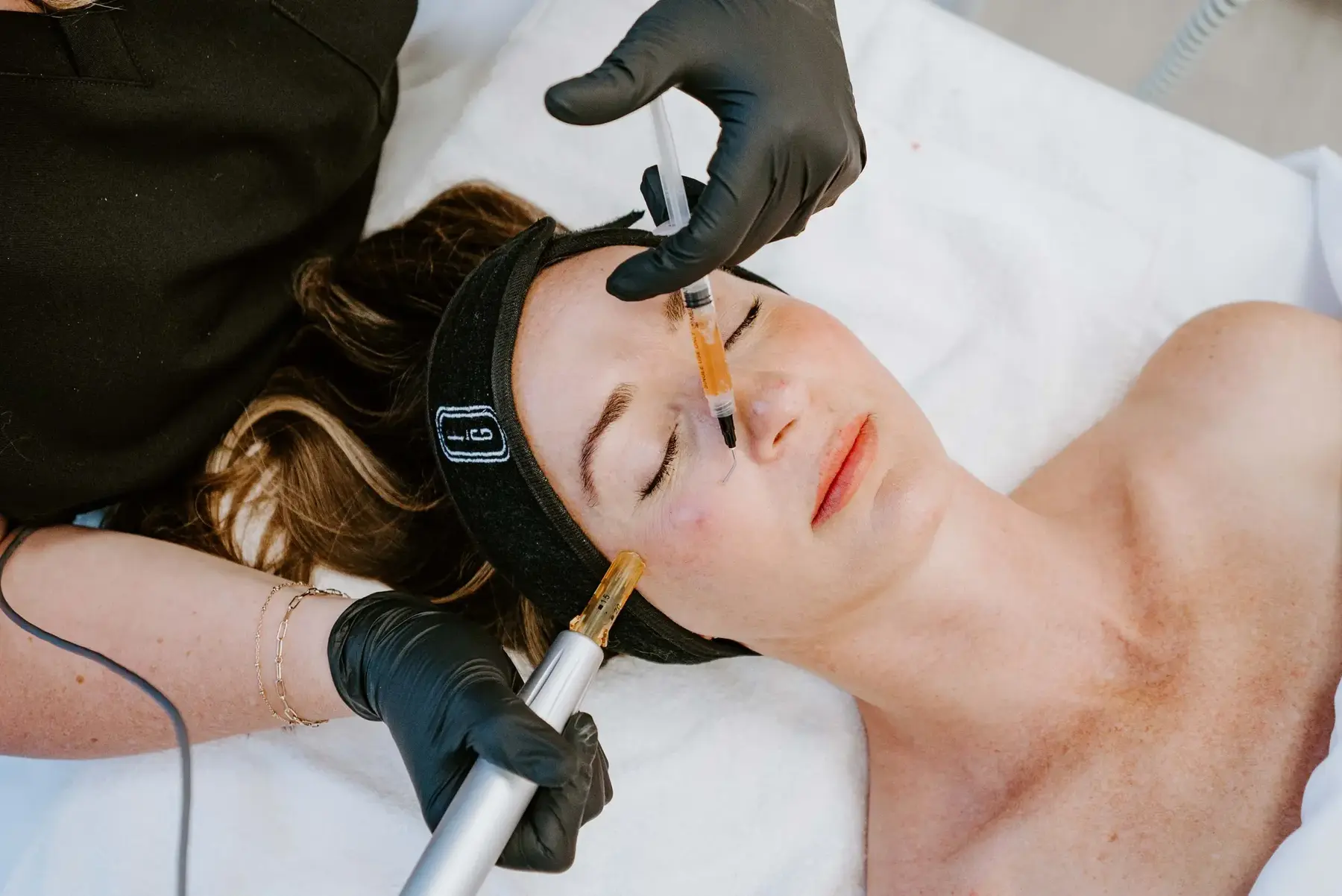 Microneedling | FG Aesthetics & Medicine | Missoula, MT