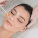 Woman receiving chemical peels facial treatment at spa in Missoula, MT