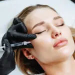 Patient receiving Face Fillers in Missoula, MT to restore cheek volume and facial contours